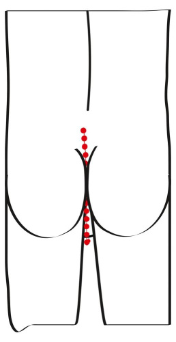 Эрекционное кольцо с цепочкой для стимуляции ягодиц фото 5