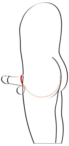 Эрекционное кольцо с цепочкой для стимуляции ягодиц фото 4