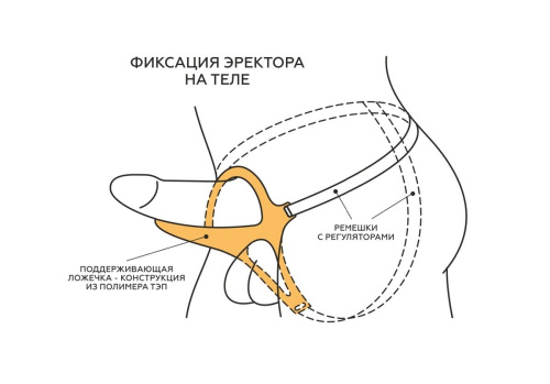 Телесный эректор-ложечка с фиксацией на ремешках MEN STYLE фото 7